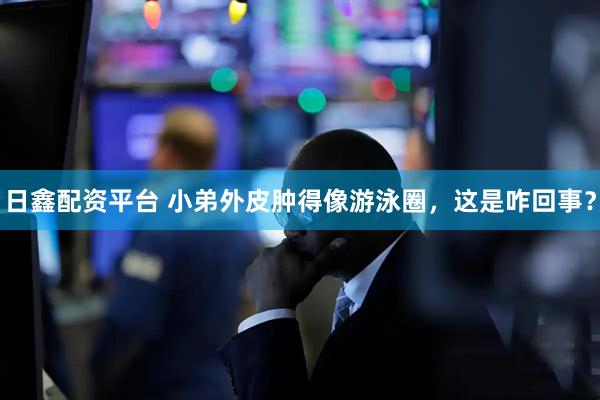 日鑫配资平台 小弟外皮肿得像游泳圈，这是咋回事？